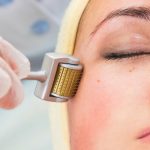 Vorteile und Vorteile von Microneedling Nachteile: Kann Microneedling Hautprobleme beseitigen? – CEL MD